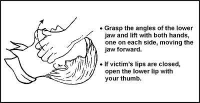 cpr Jaw-Thrust-First-Aid